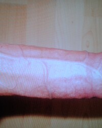 photo-thumb