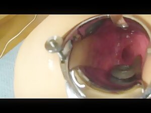 Live eel anal insertion with speculum 2 - ZooSkool Videos