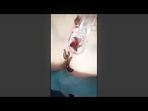 leaches in pussy 01